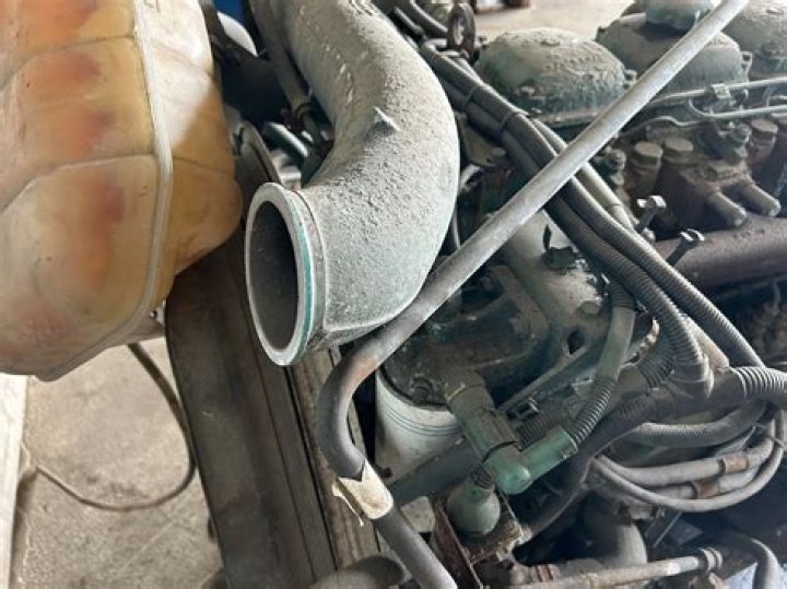 تجاربكم مع فيلر البكيني لتضيق المهبل