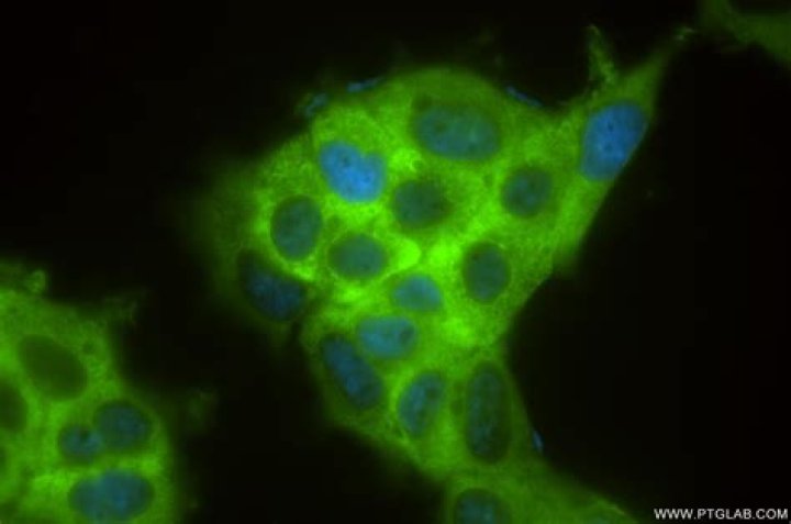 ماذا يحدث عندما تؤثر قوة محصلة في جسم ؟