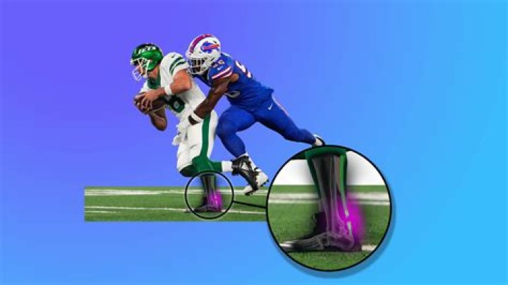 New York Jets QB Aaron Rodgers suffers season-ending Achilles tendon tear