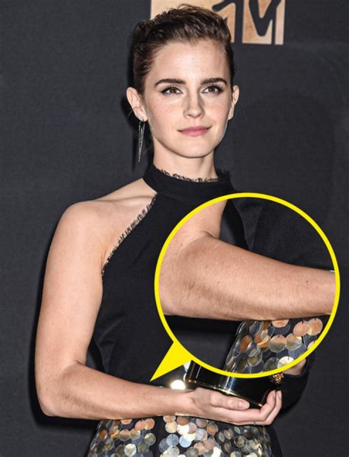 Embracing Natural Beauty: Actresses With Arm Hair