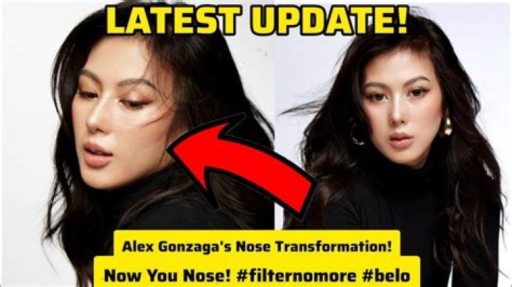 Exploring The Nostalgic Journey Of Alex Gonzaga Through Old Pictures