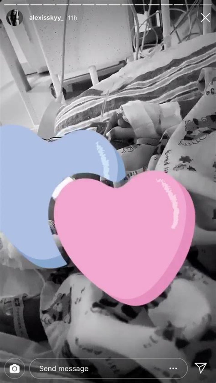 Alexis Skyy, Fetty Wap's Baby Undergoes Surgery