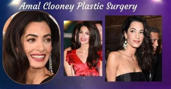 Amal Clooney Plastic Surgery: An In-Depth Look At The Rumors And Realities
