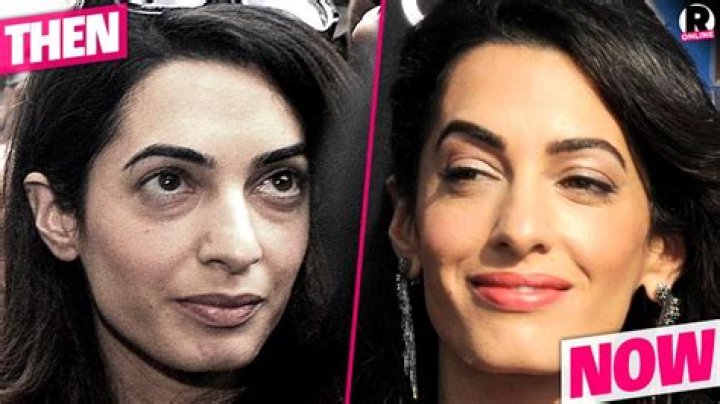 Amal Clooney Surgery: What You Need To Know