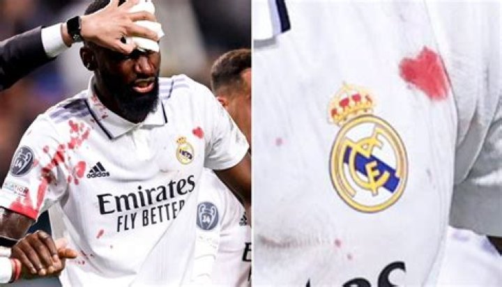 Bloodied ex-Chelsea star Antonio Rudiger 'left needing 20 stitches' after scoring last gasp Real Madrid equaliser