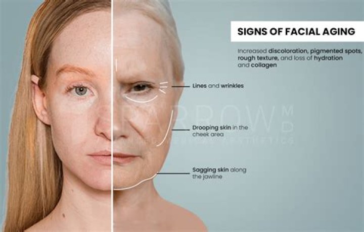 Question: At What Age Does Your Face Slim Down