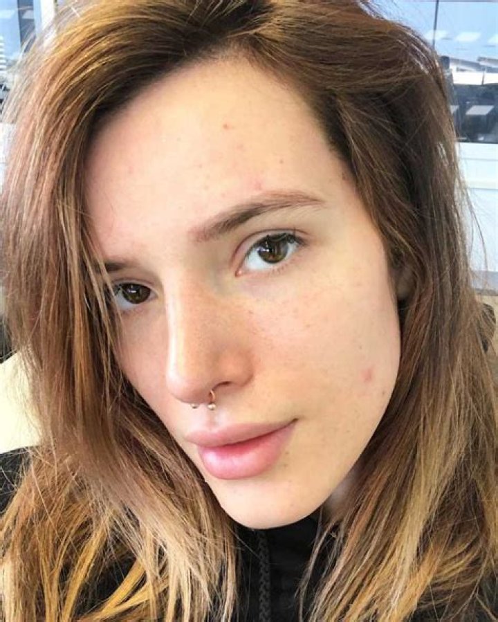 Bella Thorne left with bloodied face after skincare treatment to remove acne – The US Sun