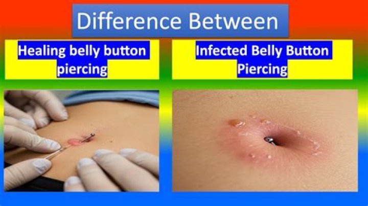Belly button piercing: infections, rejections, pain and how long it takes to heal