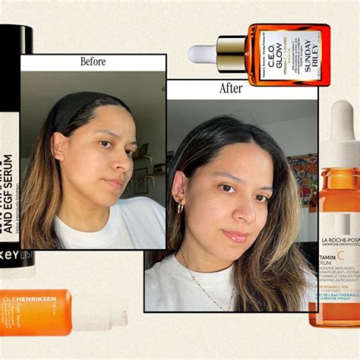 The Best Vitamin C Serums for Acne-Prone Skin