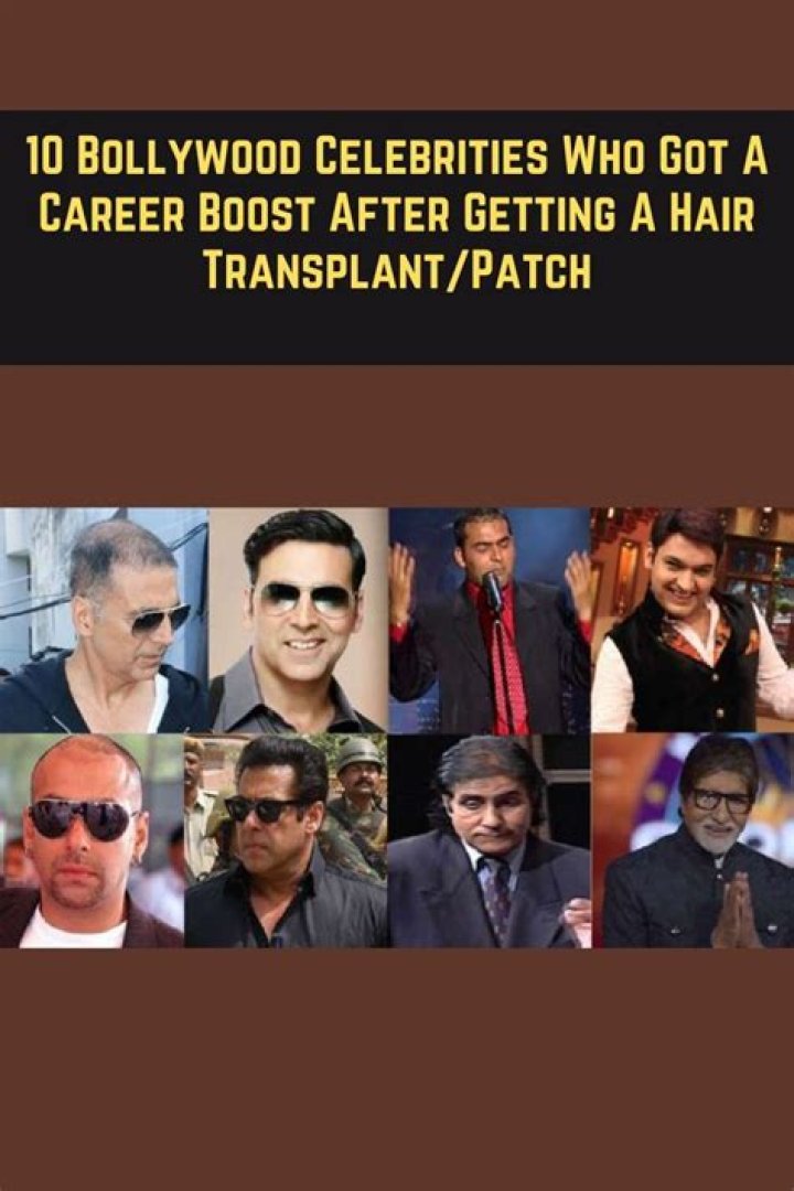 Bollywood Celebrities Who Got A Career Boost After Getting A Hair Transplant/Patch