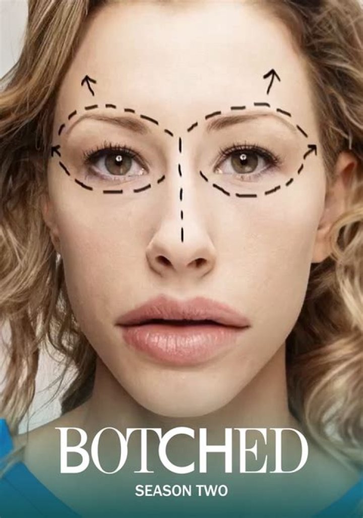 Botched Season 2 Premiere Video: Woman Injects Cement Into Her Face
