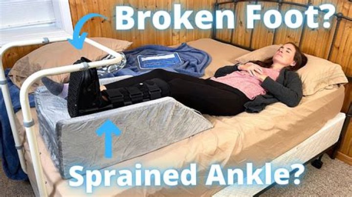 Question: Can I Sleep On My Side After Ankle Surgery