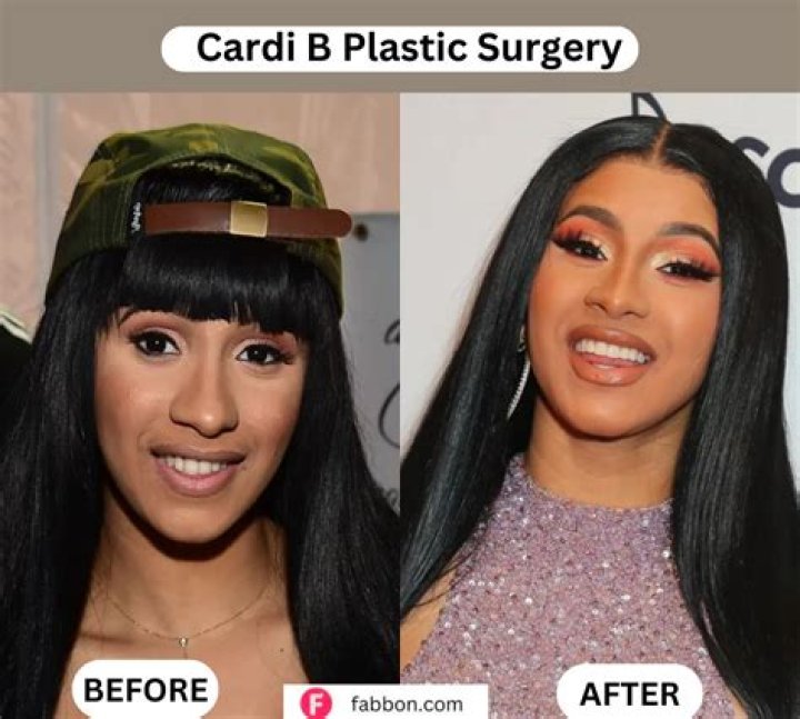 Cardi B credits plastic surgery for giving her confidence after feeling 'ugly and undeveloped' as a teen