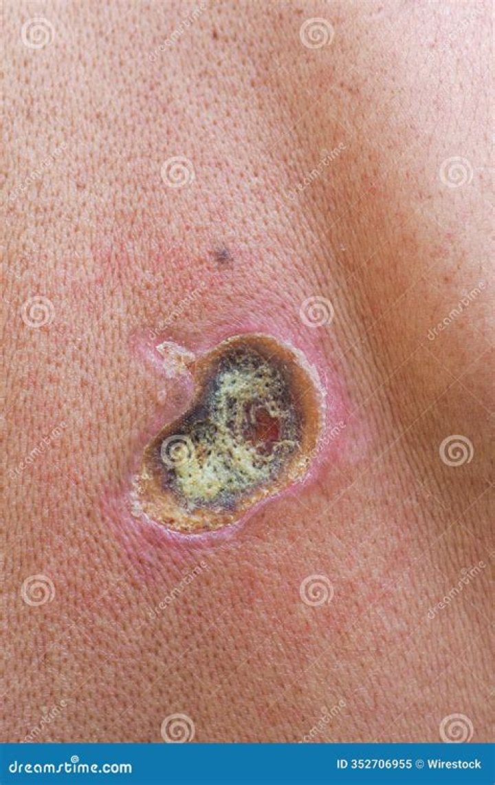 Carer charged after girl, 4, died with ‘bite marks, cigarette burns and open wounds with infected homemade stitches’ – The US Sun