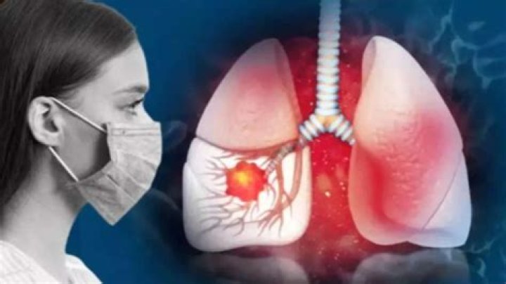 Its symptoms and prevention here – India TV