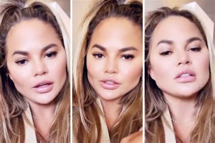Chrissy Teigen Reveals Results of ‘Fat Removal’ Face Surgery: Photo
