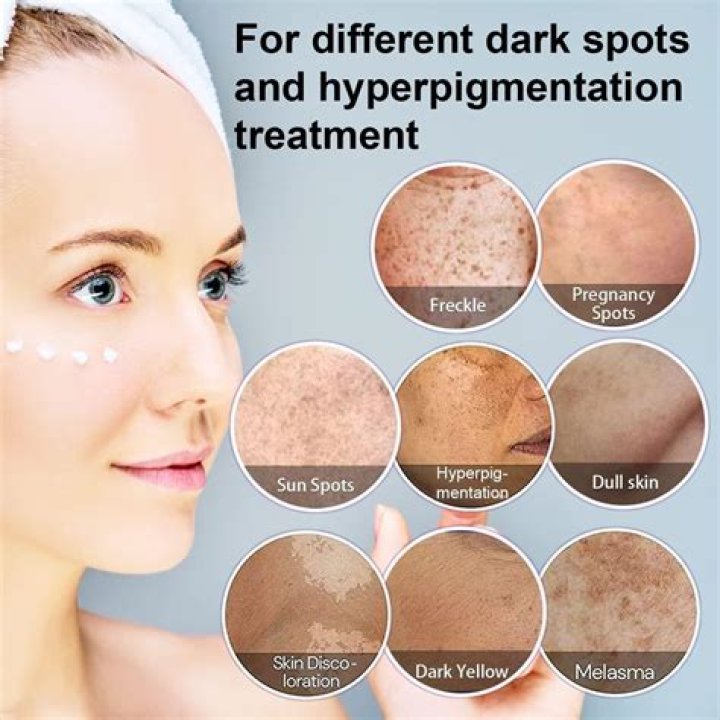 This Dark Spot Serum Has Changed the Lives of Over 4,000 Shoppers
