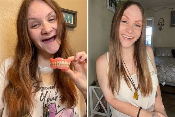 I got dentures at 23 after losing my teeth to drug addiction, people said I won't get a man but I’m very confident