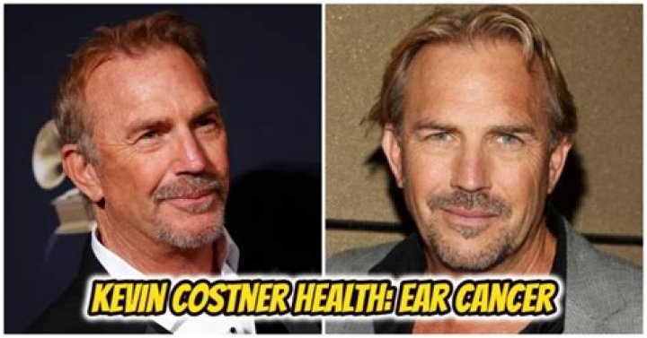 Does Kevin Costner Have Cancer? Understanding The Truth Behind The Rumors