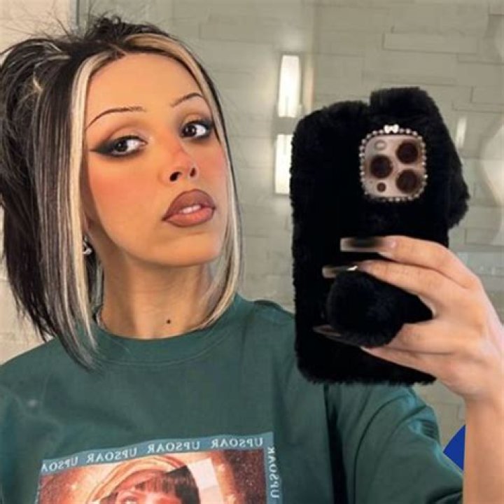 Doja Cat Shares Selfie Of Spotty Skin – And It's So Refreshing