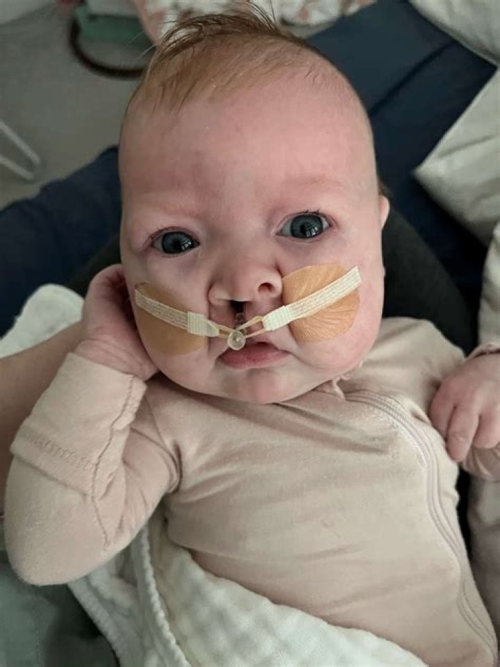 Duck Dynasty Daughter With Cleft Lip, Palate Teaches "True Beauty"
