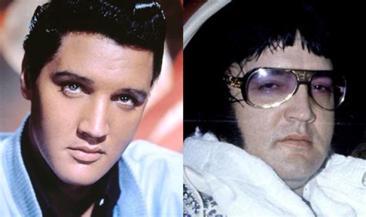 Elvis Presley Cause Of Death: A Comprehensive Exploration Of The King Of Rock And Roll's Final Days