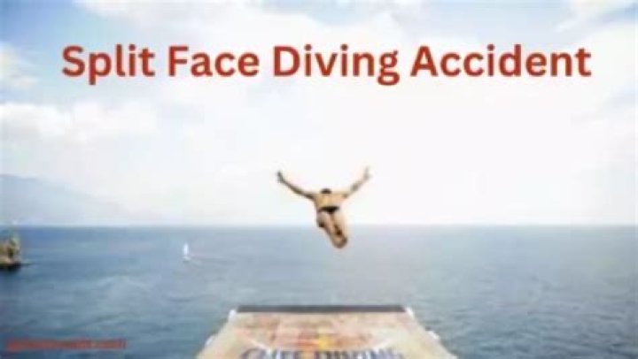 Face Split Diving Accident Incident Spain: Everything’s we know about incident