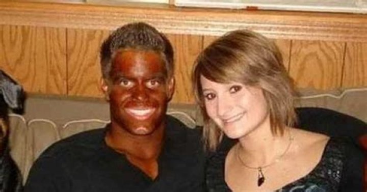 When Self-Tanning Goes Wrong: The Chronicles Of Fake Tan Fails