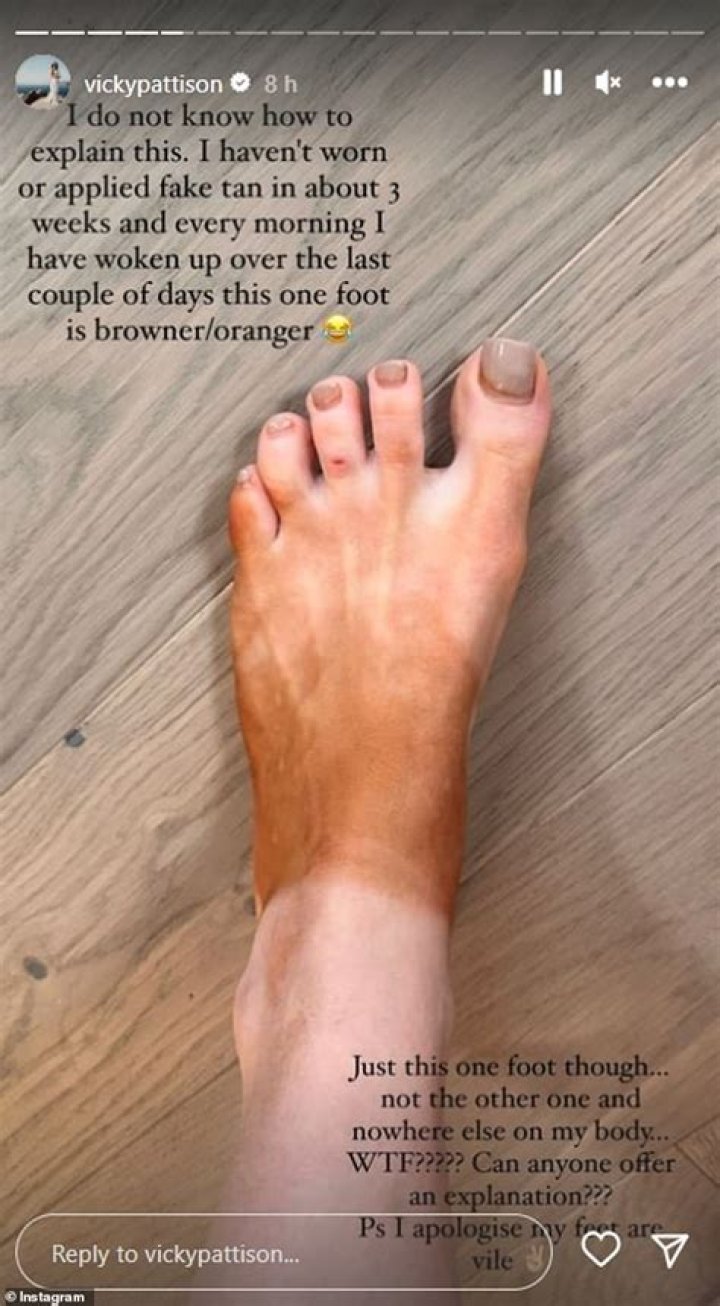 Fake tan fan reveals how to perfectly tan your feet - but is savaged for chaotic method