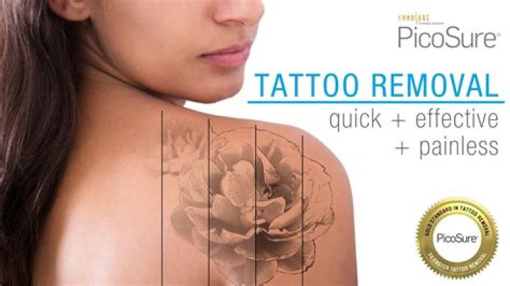 Groupon's offering free removal to ink fans who have a tattoo of the wrong star sign following 'Nasa’s 13th horoscope'