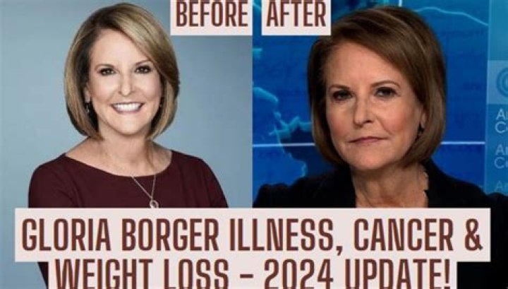 Gloria Borger Illness 2024: Understanding The Health Challenges Of A Renowned Journalist