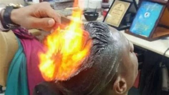 18-year-old hospitalised with burn injuries after 'fire haircut' at salon goes wrong – India TV