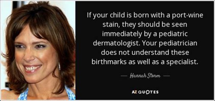 Unveiling Hannah Storm's Birthmark: A Fascinating Journey Through Her Life