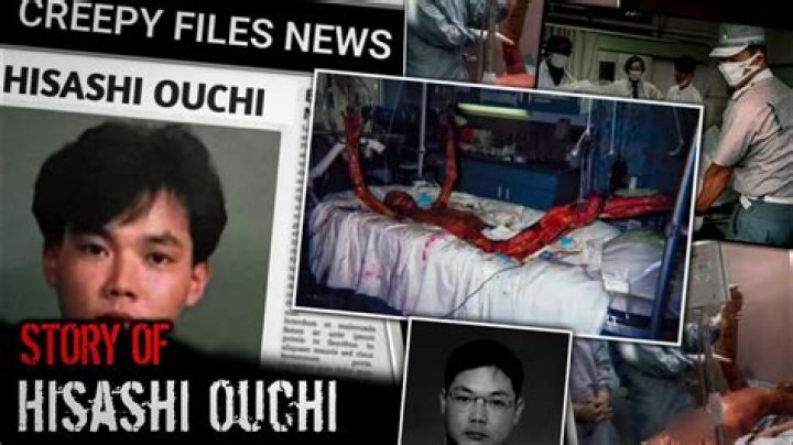 Hisashi Ouchi: The Real Story Behind The Tragic Incident