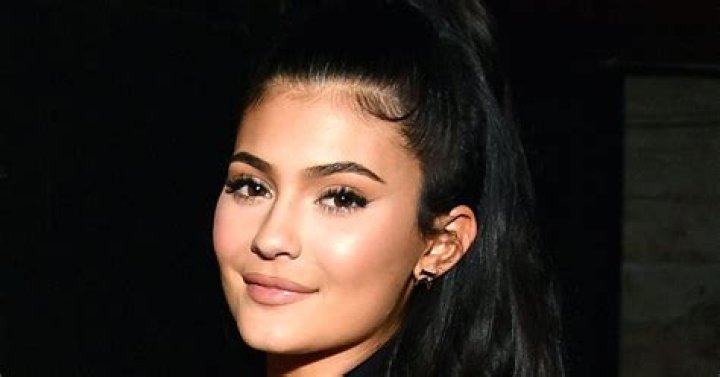 How Kylie Jenner Could Be Dissolving Her Filler: Doctor Commentary