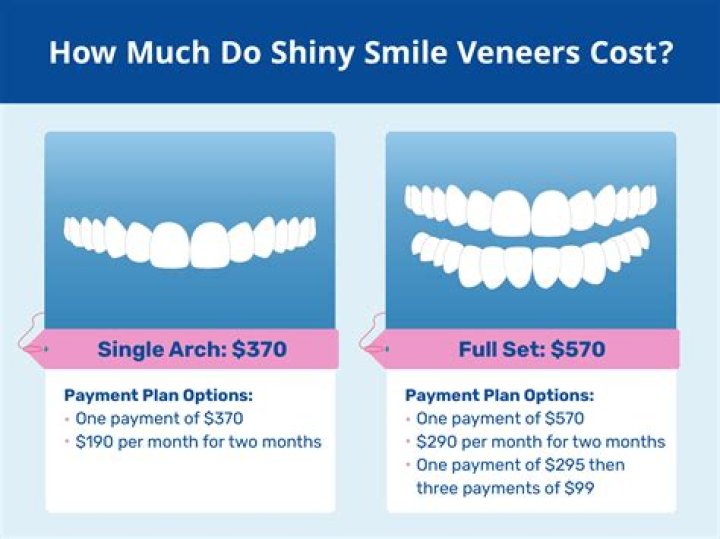 Quick Answer: How Much Is A Full Set Of Veneers