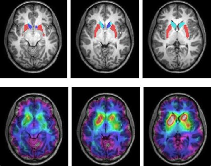 Quick Answer: How To Embed A Hyperlink In A Png