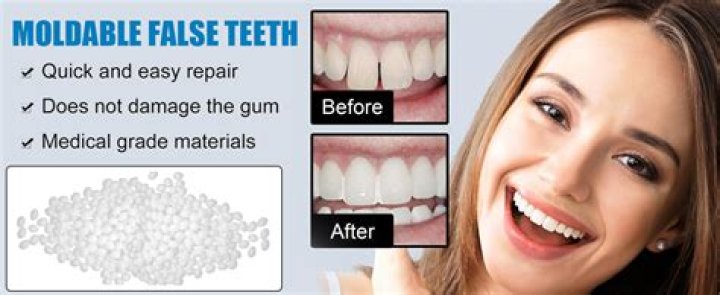 Quick Answer: How To Make A Tooth Filling At Home