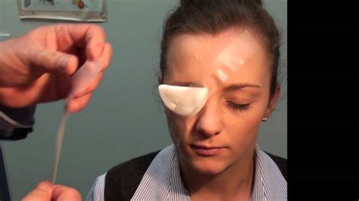 Quick Answer: How To Make Diy Eye Patch