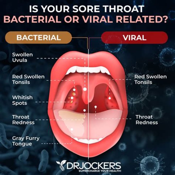 Question: How To Treat Sore Throat From Cleaning Products