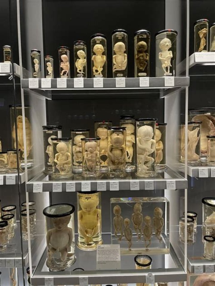 Major mystery as human remains found 'preserved' in a JAR in Liverpool house