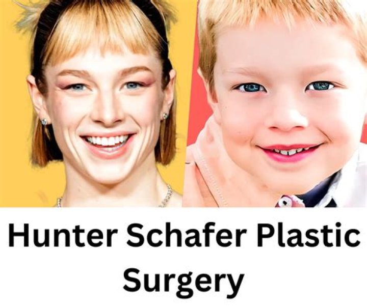 Understanding Hunter Schafer's Journey: Trans Surgery And Beyond