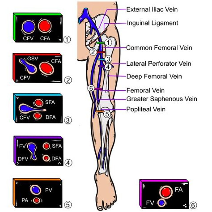 ICD-10 Codes For Deep Vein Thrombosis (DVT): A Comprehensive Guide