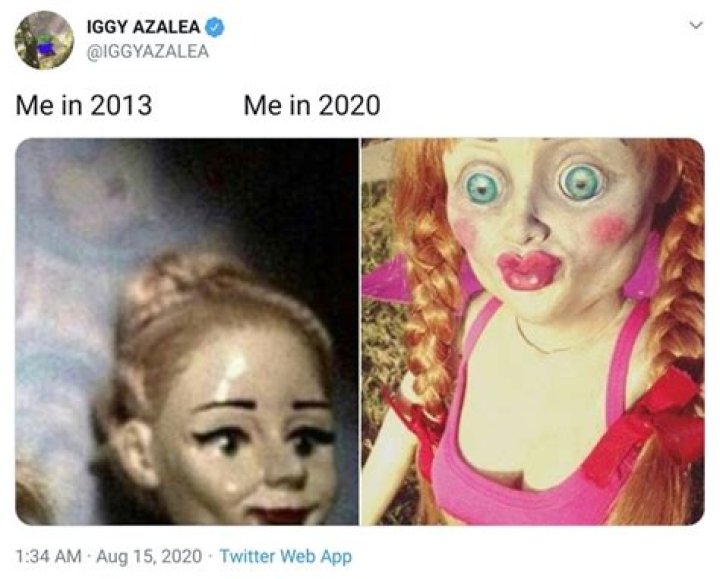 Iggy Azalea makes hilarious joke about how much her face has changed from her numerous surgeries