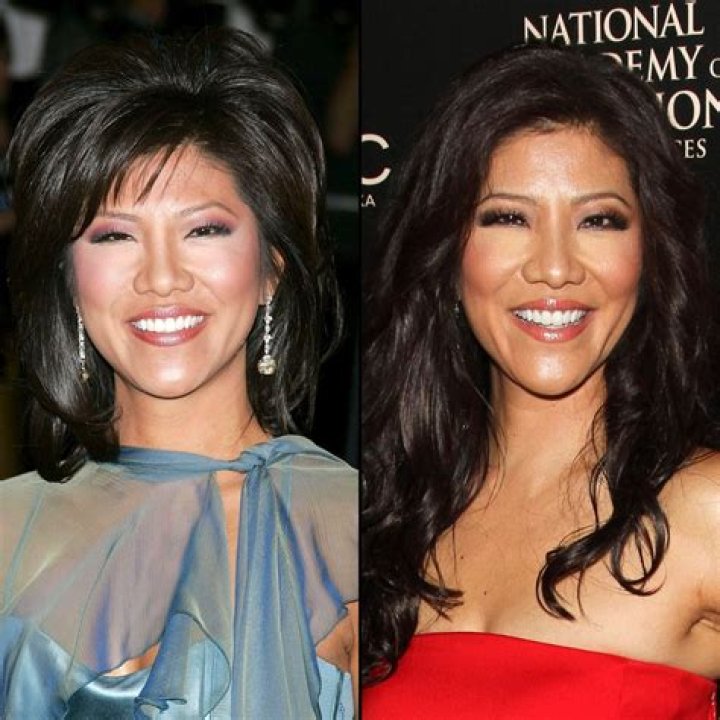 Julie Chen Plastic Surgery Confession: Before and After Pictures
