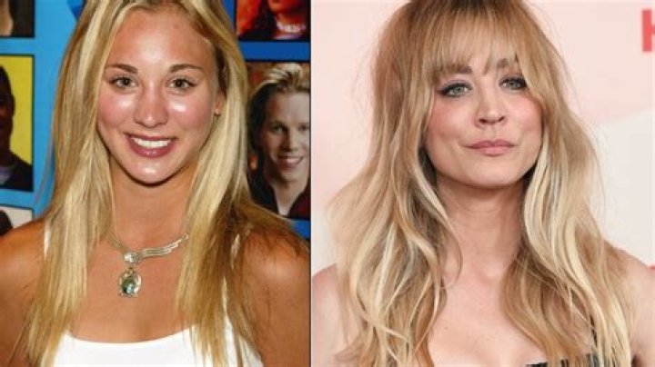 Kaley Cuoco Had a Nose Job, Boob Job: ‘Best Thing I Ever Did’