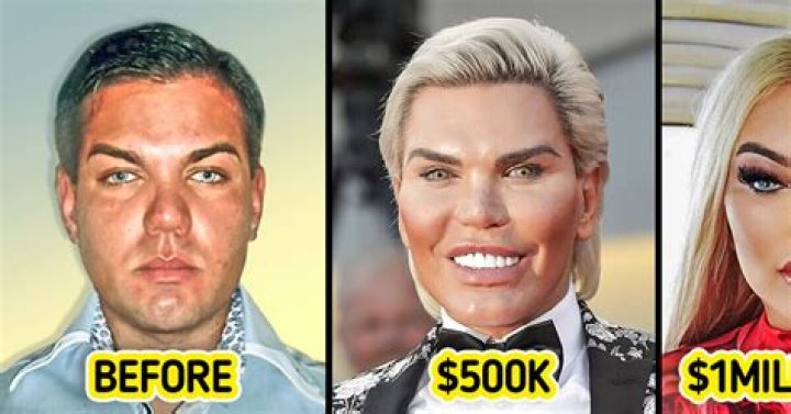Transforming Beauty: The Journey Of Ken And Plastic Surgery