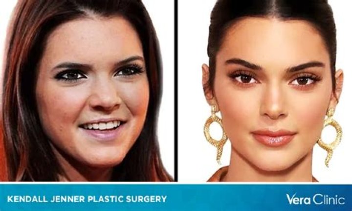 Kendall Jenner leaves plastic surgeon's in a FULL face mask as Kim Kardashian, Khloe & Kylie admit to getting work done