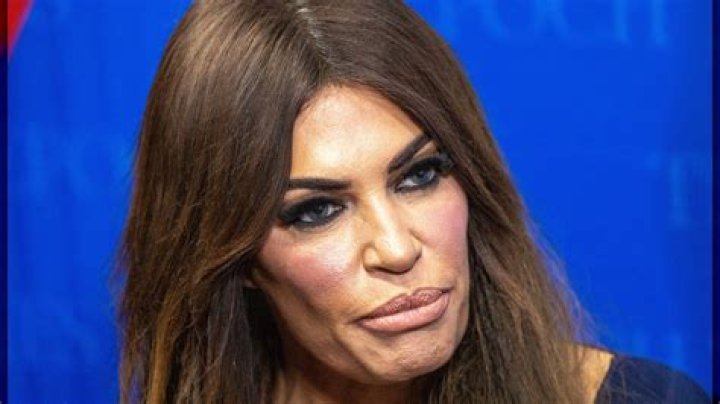 Exploring The Allure Of Kimberly Guilfoyle's Face