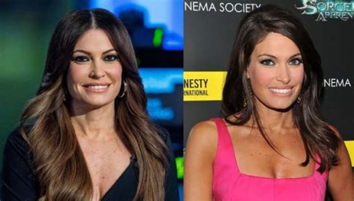 Unveiling The Transformation: Kimberly Guilfoyle's Journey Through Plastic Surgery